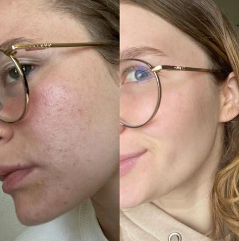 Masajeador Facial Multifuncional - Tienda Online